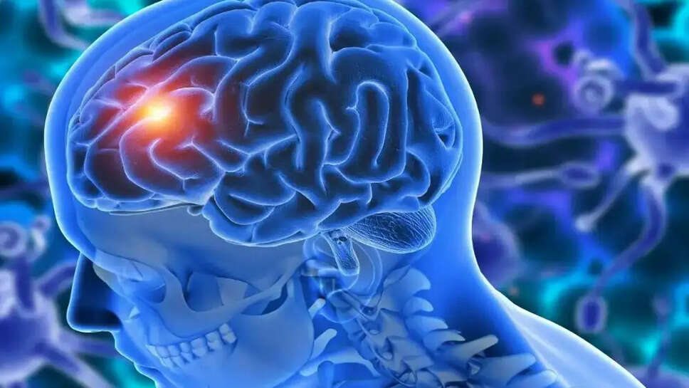 Brain tumor news
